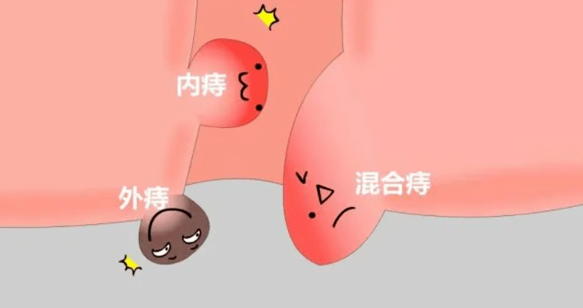 ̯@ʲô@ôʹ(dng)Ѫ˨